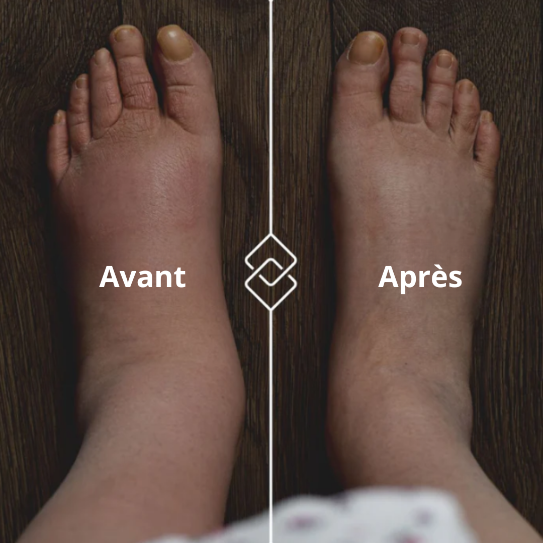 Chaussette de compression SOX